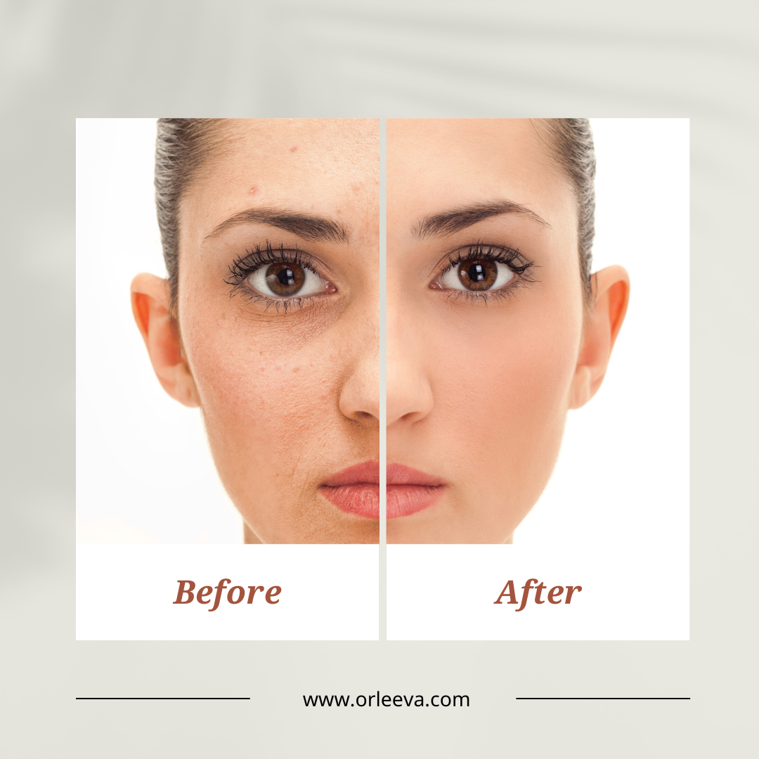 Serum, Facewash & Night Cream